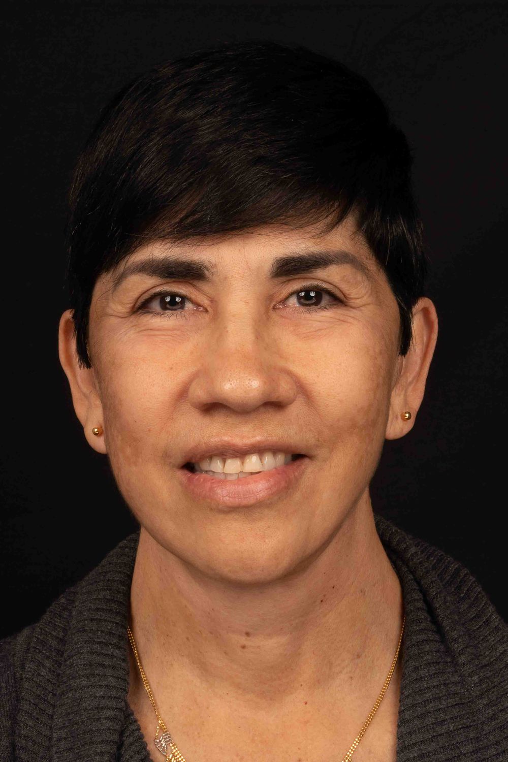 Facelift Before & After