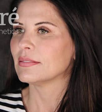 Eyelid Surgery Before & After