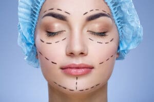 Close up portrait of woman with marker marks on her face pre surgery