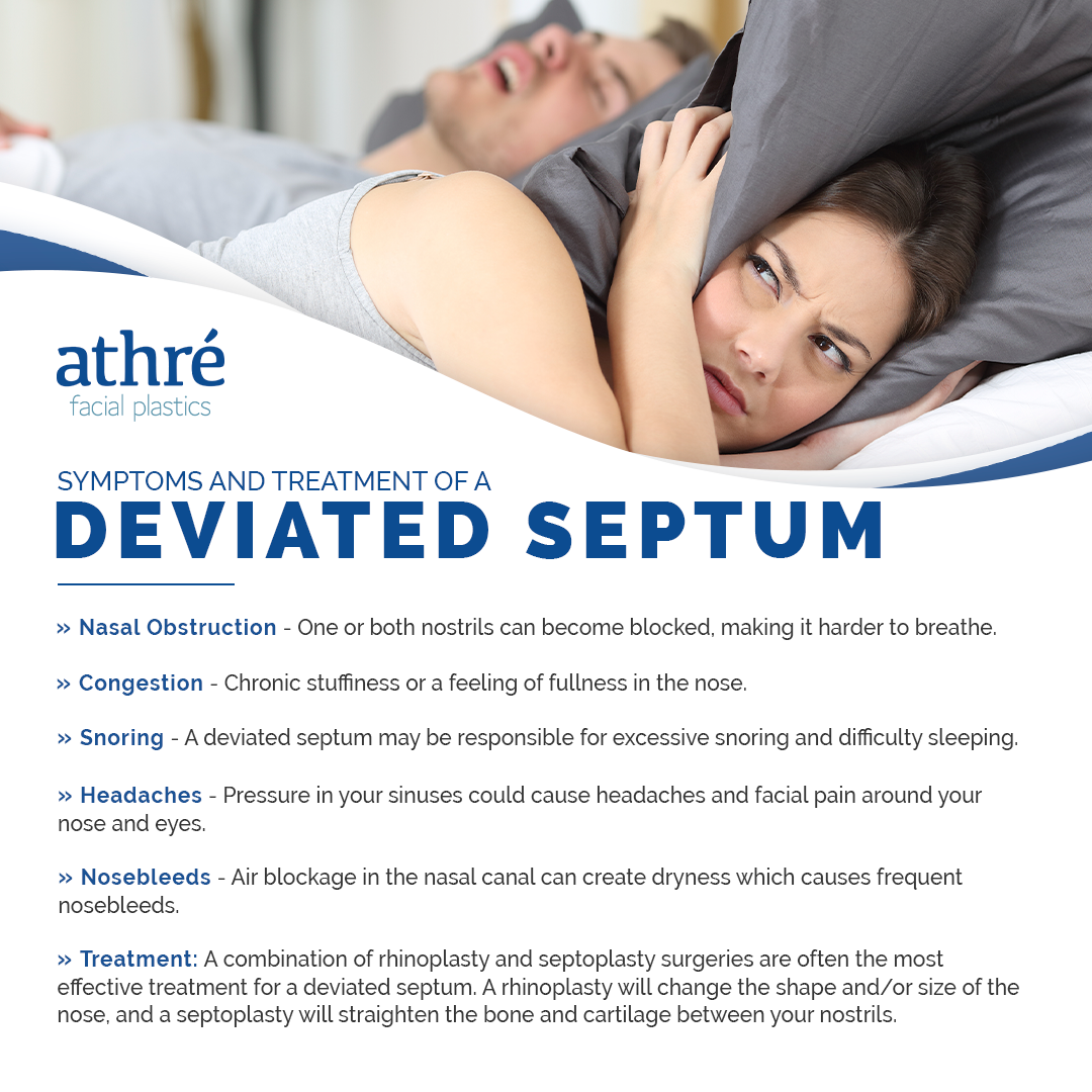 Symptoms And Treatment of a DEVIATED SEPTUM