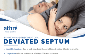 Symptoms And Treatment of a DEVIATED SEPTUM