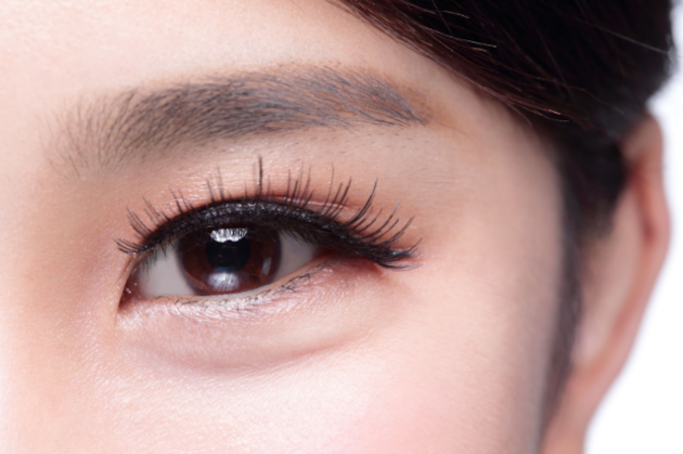Asian eyelid surgery 1